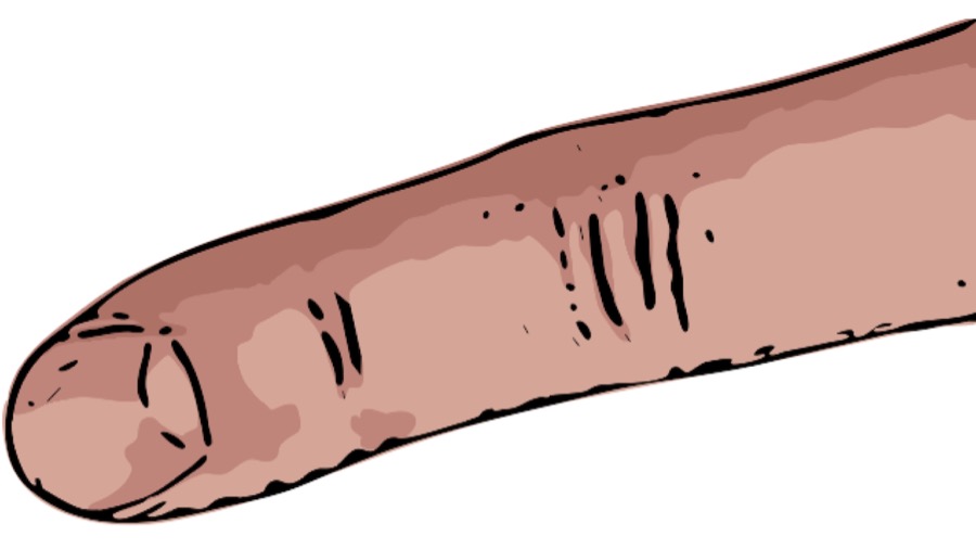 dito